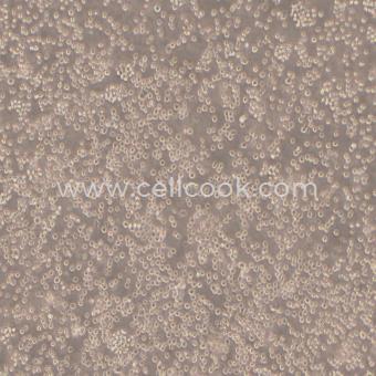 THP-1人急性單核細(xì)胞白血病細(xì)胞（STR鑒定正確）