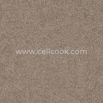 CCRF-CEM人急性淋巴細(xì)胞白血病T淋巴細(xì)胞（STR鑒定正確）