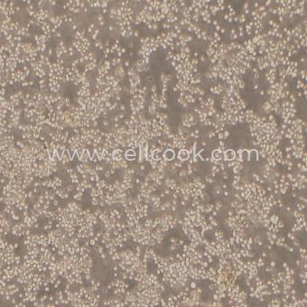 HEL人紅白細胞白血病細胞（STR鑒定正確）