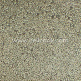 Kasumi-1人急性髓母白血病細胞（STR鑒定正確）