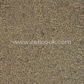 NB-4人急性早幼粒白血病細胞（STR鑒定正確）