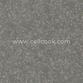 NALM6 B系急性淋巴細胞白血病細胞（STR鑒定正確）