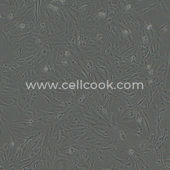 SW1353人骨肉瘤細胞（STR鑒定正確）