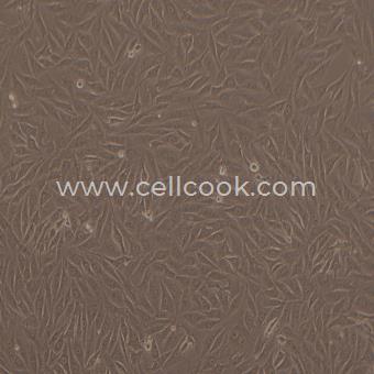 MG-63人成骨肉瘤細胞（STR鑒定正確）