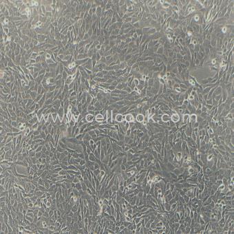 143B人骨肉瘤細胞（STR鑒定正確）