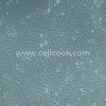 SAOS-2人成骨肉瘤細胞（STR鑒定正確）