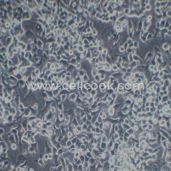 Neuro-2a小鼠神經(jīng)母細(xì)胞瘤細(xì)胞（STR鑒定正確）