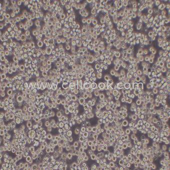 S-180小鼠腹水瘤細(xì)胞