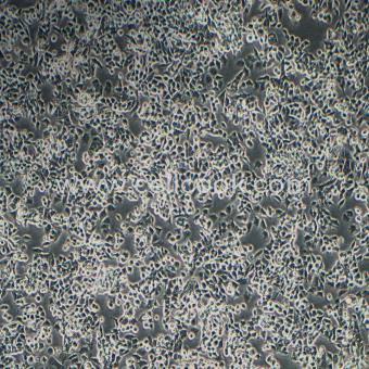 SNU-398人肝癌細(xì)胞（STR鑒定正確）