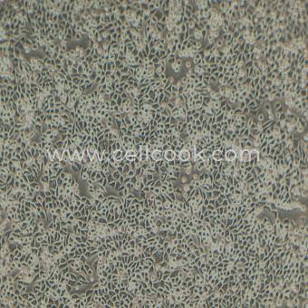 L WNT-3A小鼠皮下結(jié)締組織細(xì)胞（種屬鑒定正確）