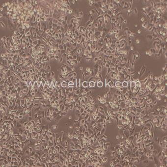 KB 人口腔表皮癌細(xì)胞