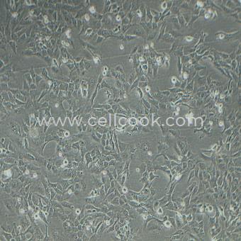 HMC3 人小膠質(zhì)細(xì)胞（STR鑒定正確）