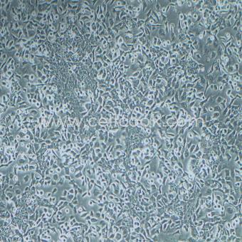 NCI-H446人小細胞肺癌細胞（STR鑒定正確）