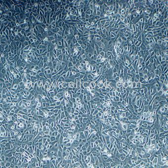 NCI-H1666人肺支氣管癌細胞（STR鑒定正確）