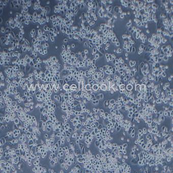 SK-BR-3人乳腺癌細(xì)胞（STR鑒定正確）