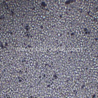 MDA-MB-453人乳腺癌細(xì)胞（STR鑒定正確）