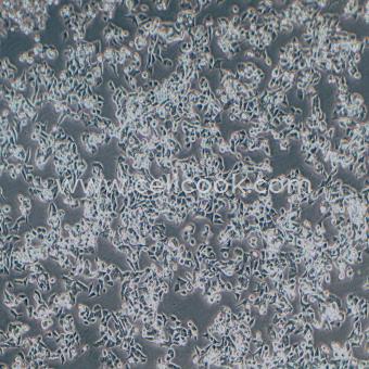 LS 174T人結(jié)腸腺癌細(xì)胞（STR鑒定正確）