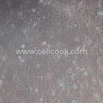 BHT-101人甲狀腺癌細胞（退行性）（STR鑒定正確）