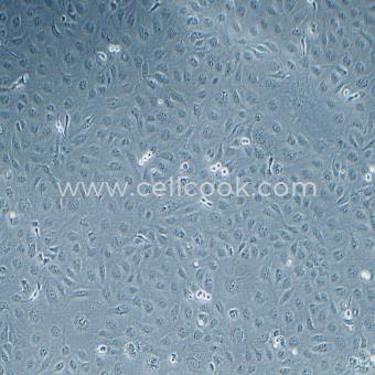 HLEC-SRA01-04人晶狀體上皮細(xì)胞（STR鑒定正確）