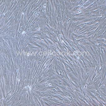 KGN人卵巢顆粒細(xì)胞瘤細(xì)胞（STR鑒定正確)