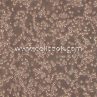 C1498小鼠白血病細(xì)胞（種屬鑒定正確）