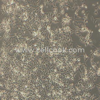 PLA-801D(95D)人高轉(zhuǎn)移肺腺癌細胞（STR鑒定正確）