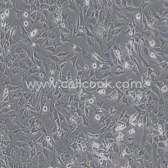 HS 578T人乳腺癌細胞（STR鑒定正確）