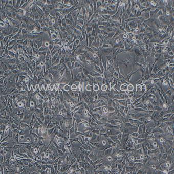 BT-549人乳腺導(dǎo)管癌細胞（STR鑒定正確）