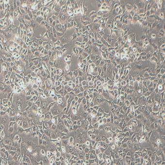 HS 746T人胃癌細(xì)胞（STR鑒定正確）