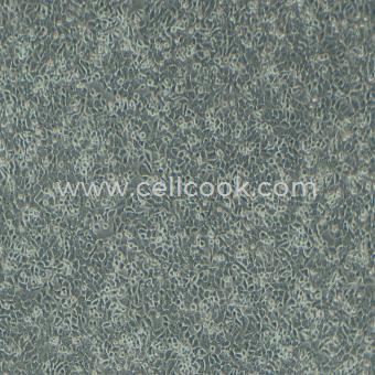 TE-1人食管癌細(xì)胞（STR鑒定正確）