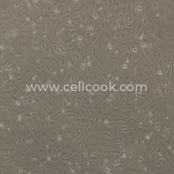 TCCSUP人膀胱癌細(xì)胞（STR鑒定正確）