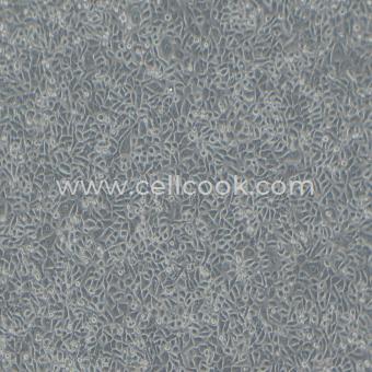 NPC/HK1人鼻咽癌細胞（STR鑒定正確）