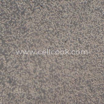 CA46人Burkitt's淋巴瘤細(xì)胞（STR鑒定正確）