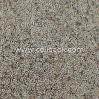 HAL-01人急性淋巴細胞白血病細胞（STR鑒定正確）