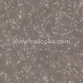 HuTu-80人十二指腸腺癌細(xì)胞（STR鑒定正確）