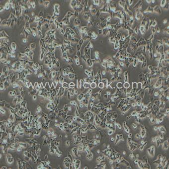 MHCC-LM3-LUC示蹤穩(wěn)定細(xì)胞株（STR鑒定正確）