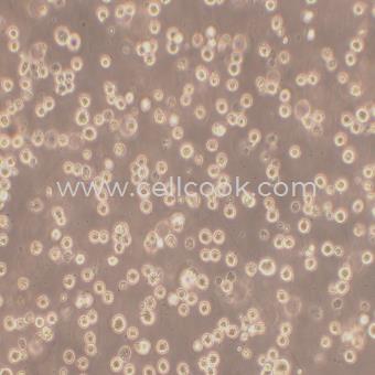 K562-DDP人慢性髓原白血病細胞順鉑耐藥株（STR鑒定正確）