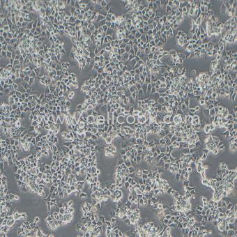 JAR人胎盤絨毛癌細(xì)胞（STR鑒定正確）