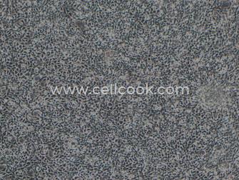 293A人胚腎細(xì)胞（STR鑒定正確）