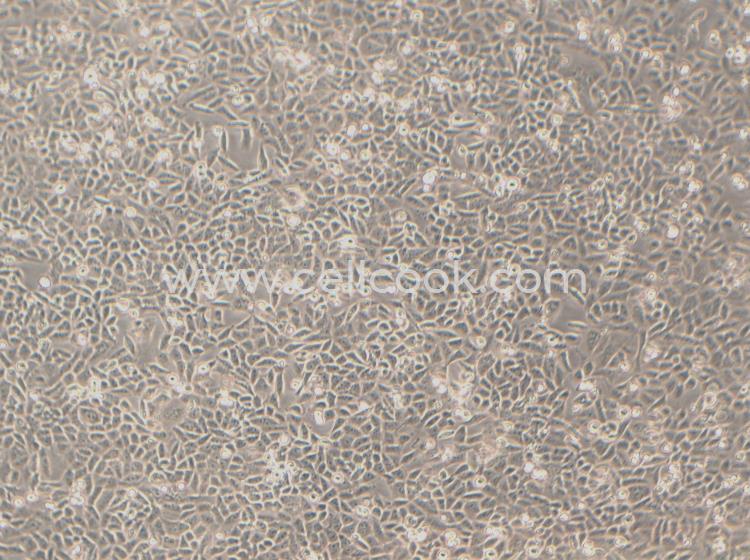 Hela-DDP人宮頸癌細胞順鉑耐藥株（STR鑒定正確）